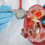 La «pandemia silenciosa» que alerta a los especialistas