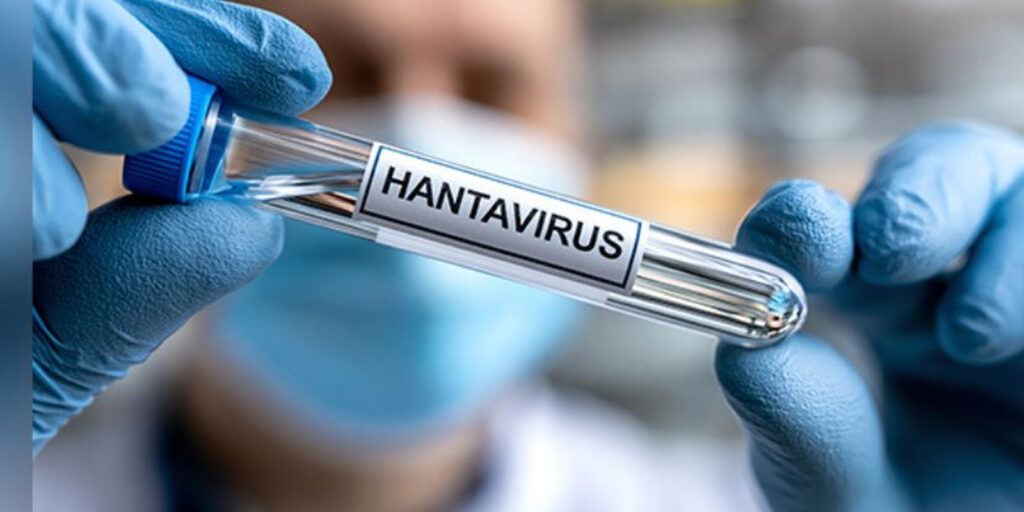 VIRUS