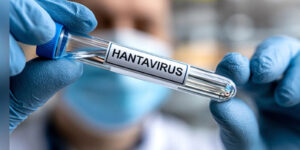 VIRUS
